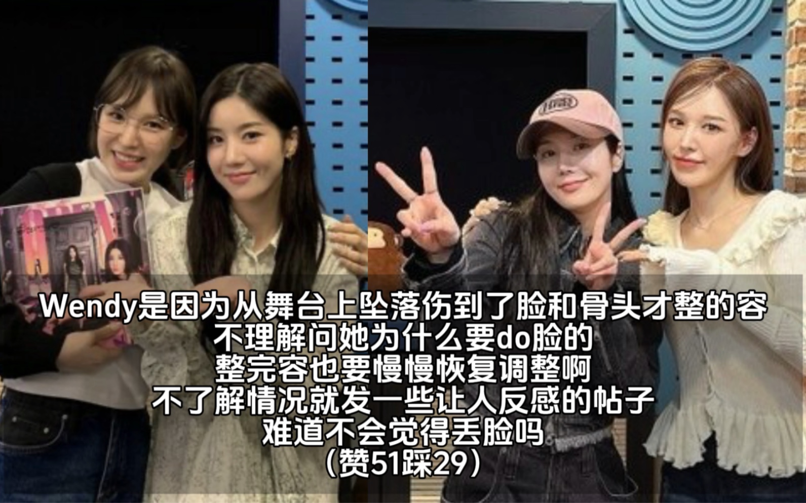 韩网热贴:wendy的脸怎么变了这么多?