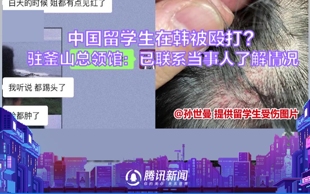 中国留学生在韩被殴打?驻釜山总领馆:已联系当事人了解情况哔哩哔哩bilibili