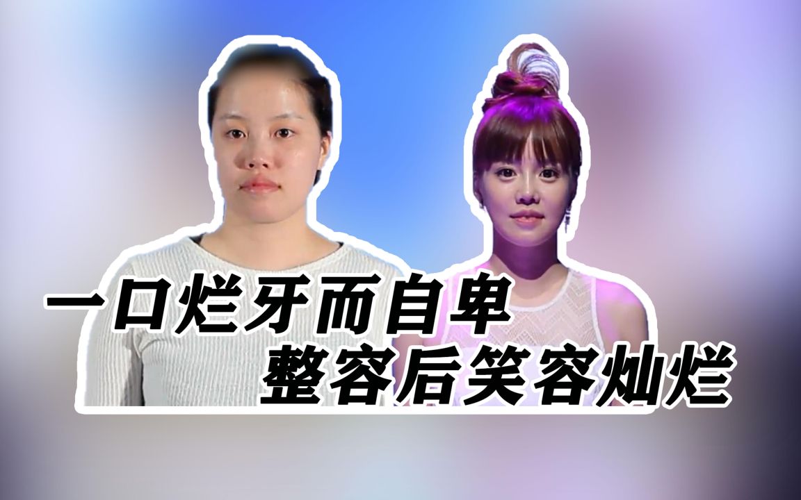 女生一口烂牙怎么拯救颜值(中)哔哩哔哩bilibili