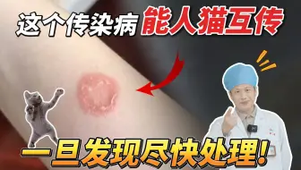 【科普】身上长猫癣传染性很强，跟着医生这样处理！
