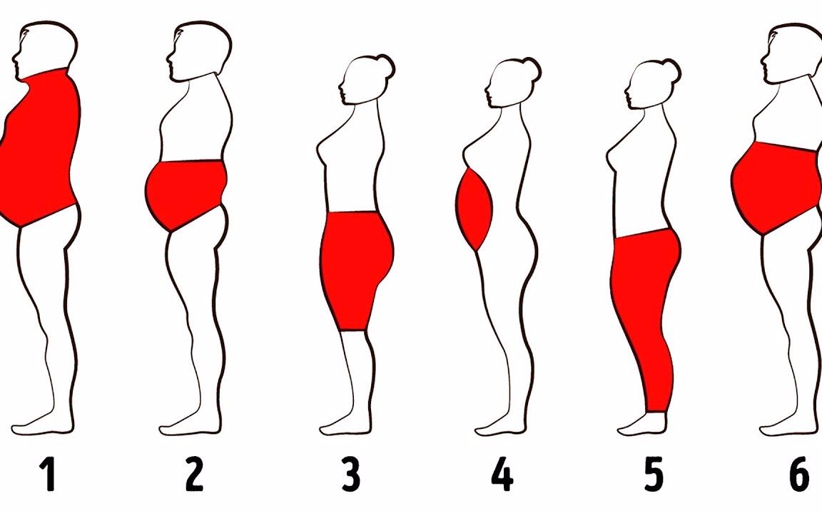 [图]6大肥胖类型，如何对症“锻炼”？