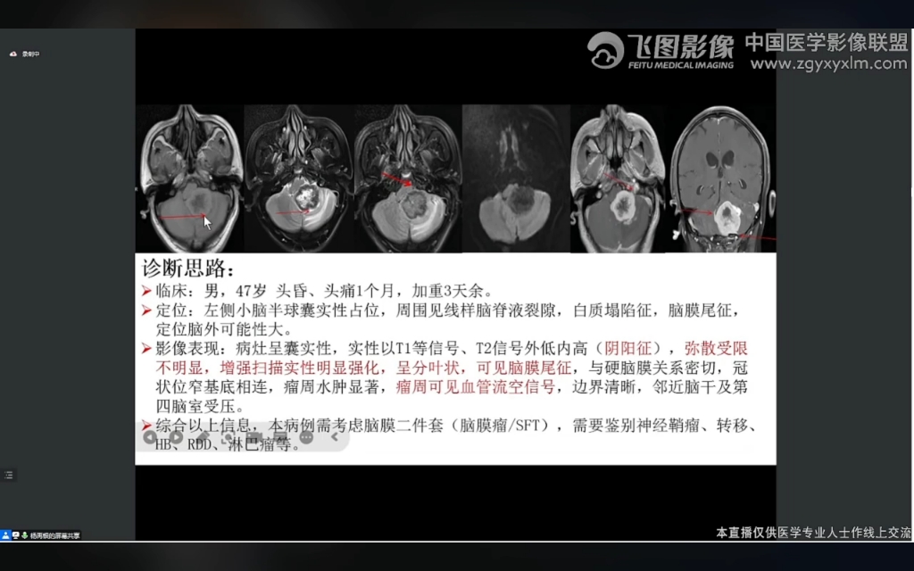 中影之家 飞图影像 病例讨论总结归纳哔哩哔哩bilibili