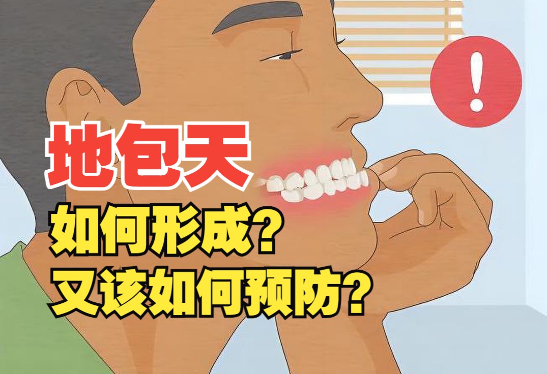 地包天是怎样形成的呢?又有什么预防措施?