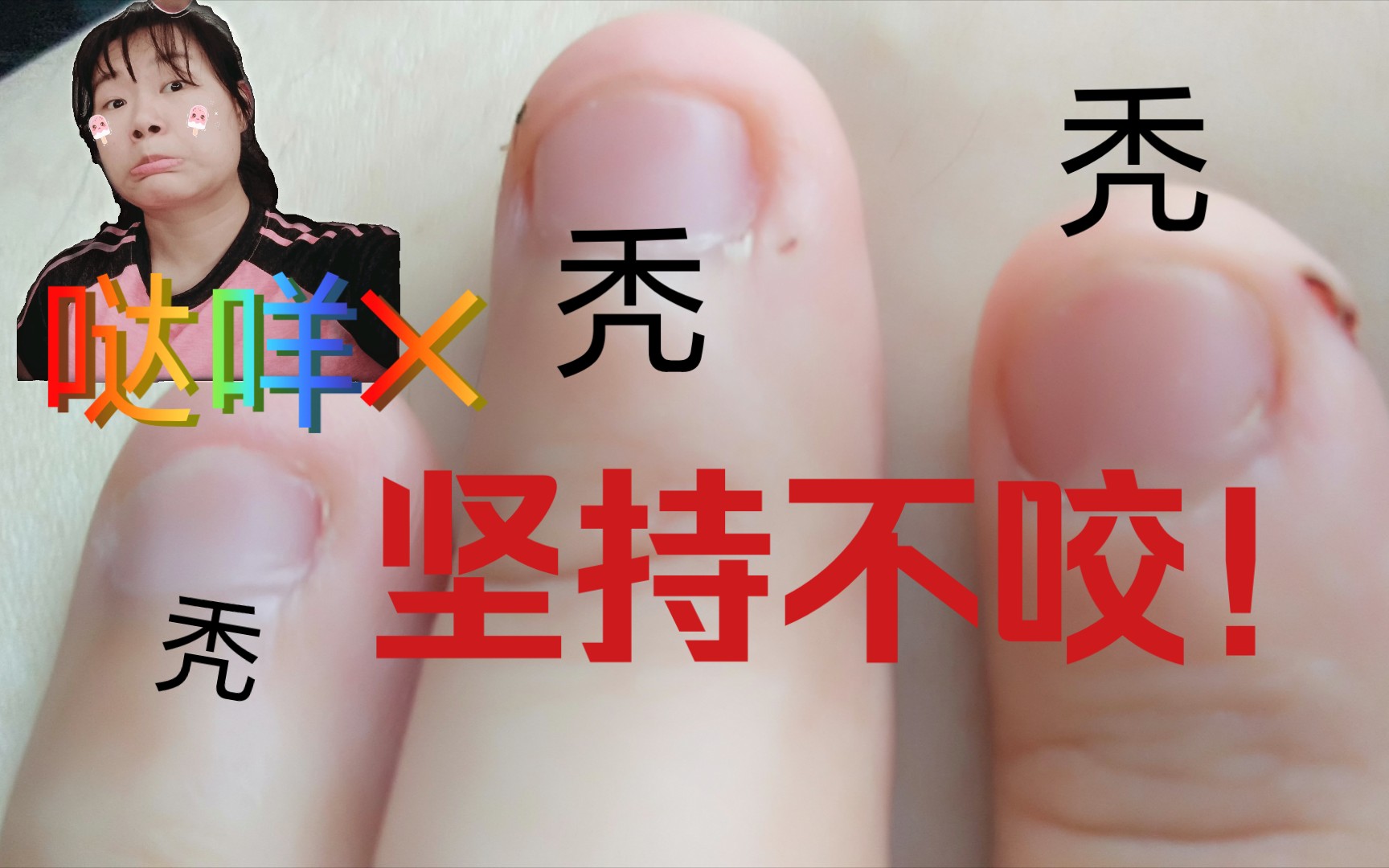 [图]坚持不咬指甲的我好难