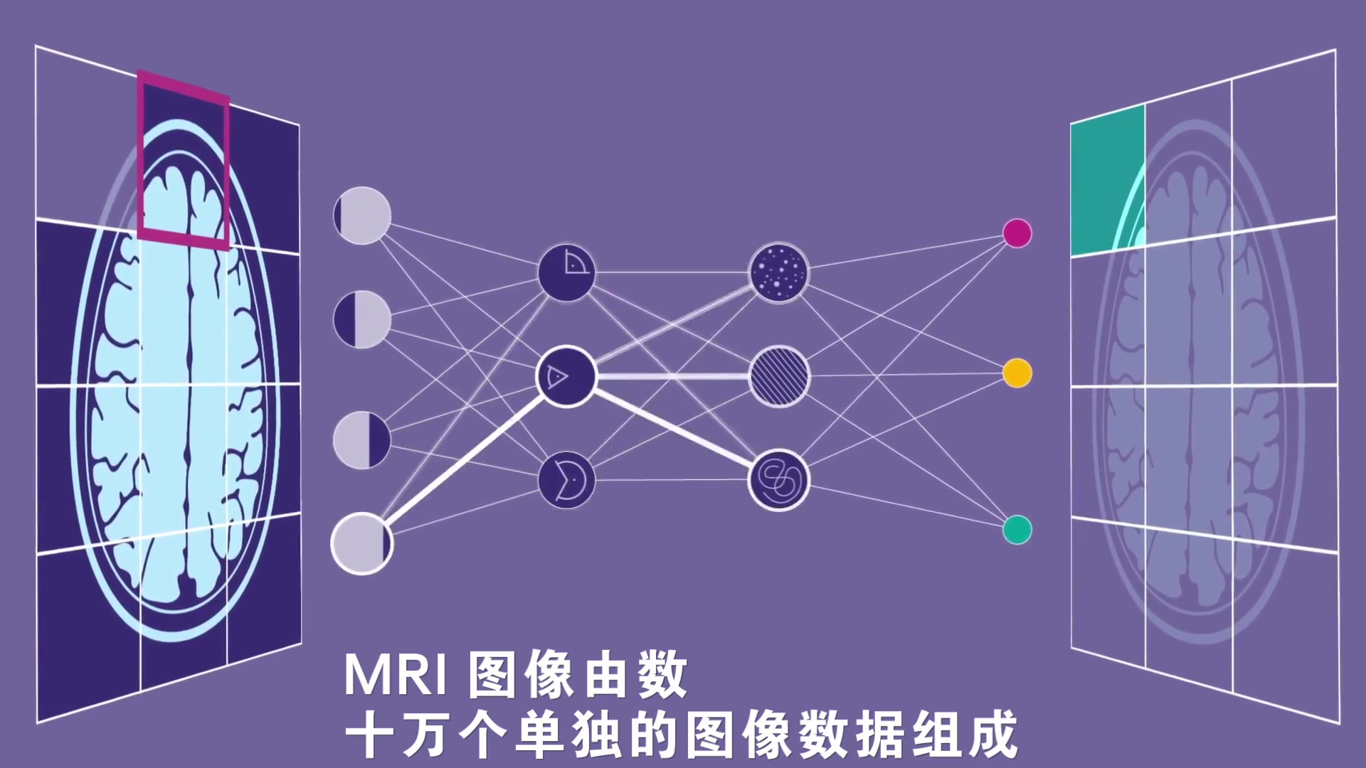 [图]【中字】人工智能在医学领域的应用和展望 ｜AI in Medicine- Possible Applications and Potentials