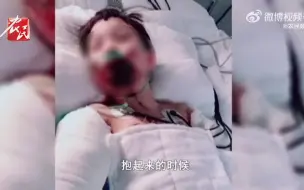 Download Video: 10岁女儿玩火碱重度烧伤单亲妈妈泪崩：女儿3岁时被确诊脑瘫