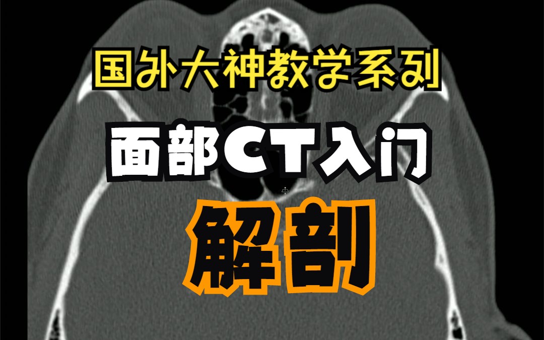 面部CT入门解读—骨窗(国外大神教学系列)哔哩哔哩bilibili