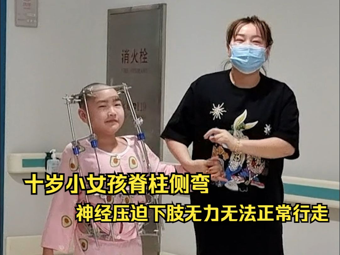 十岁小女孩脊柱侧弯,神经压迫无法正常行走