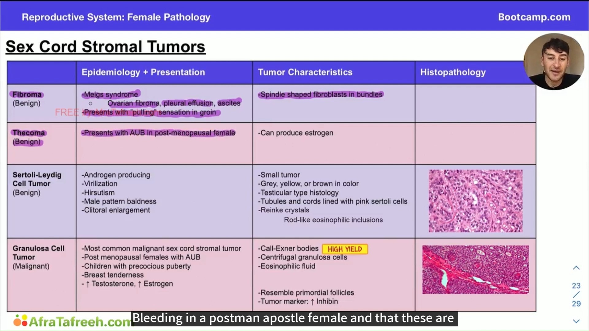 4.11Ovarian Cancer Subtypes哔哩哔哩bilibili