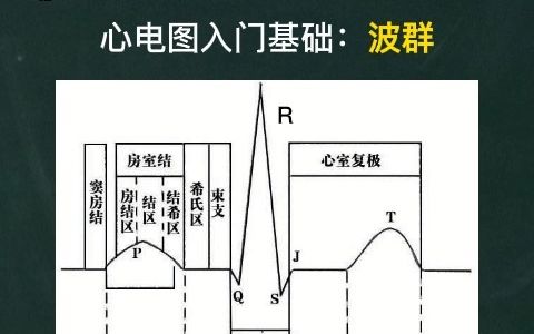 心电图入门基础:每个波形分别表示什么内涵?哔哩哔哩bilibili