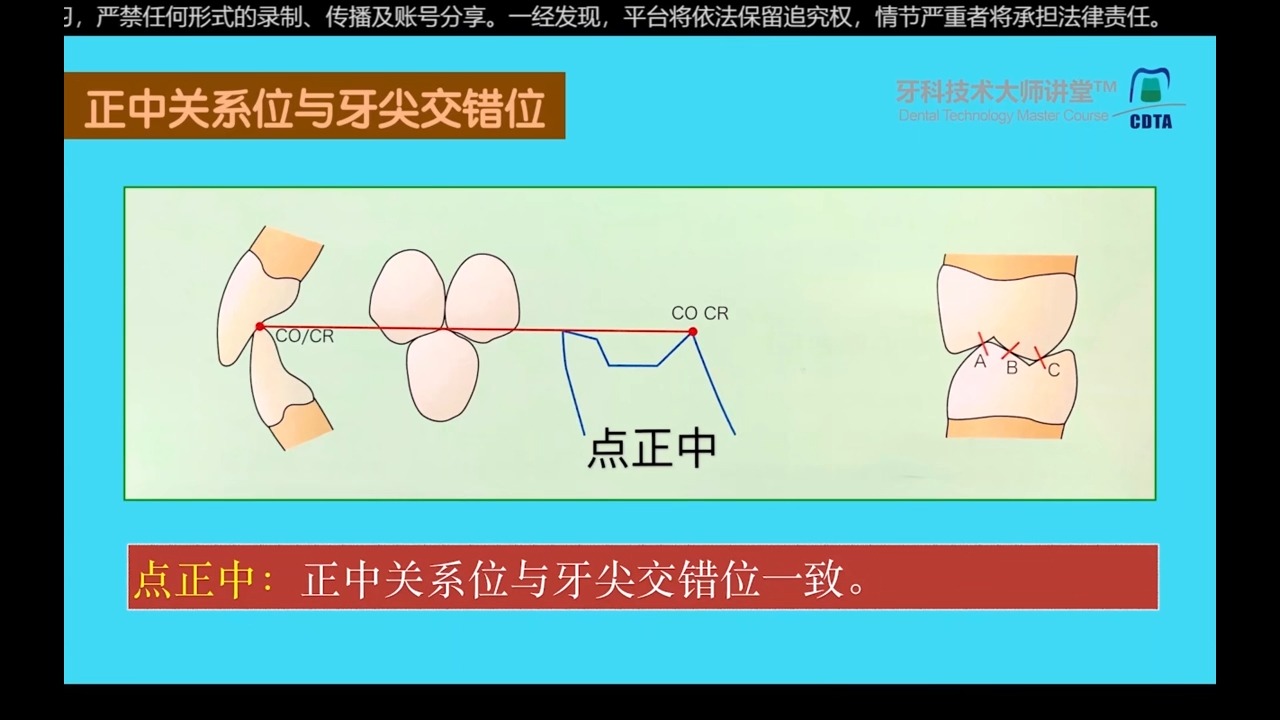 跟汤老师学咬合-02 磨牙正中关系