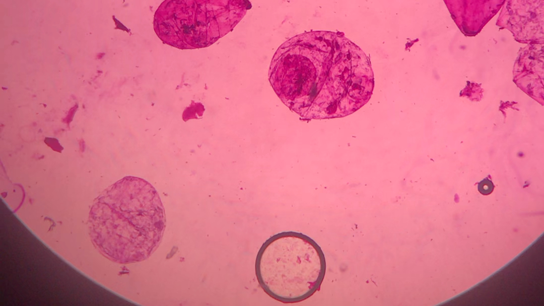 番茄果肉细胞显微图图片