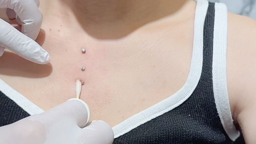 直角埋钉 单颗埋钉效果