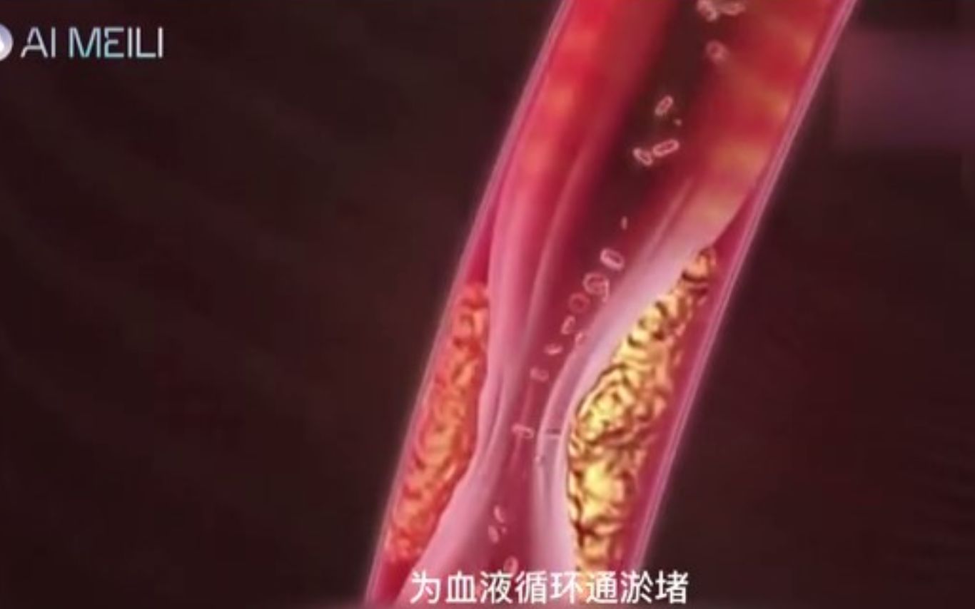 【AI美丽】生物微电流对人体有什么好处哔哩哔哩bilibili