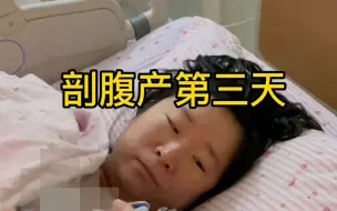 Tải video: 生完孩子后的变化|||姐妹们，我又来向大家汇报工作了。剖腹产第三天，称了下体重，没想到才轻这么点。