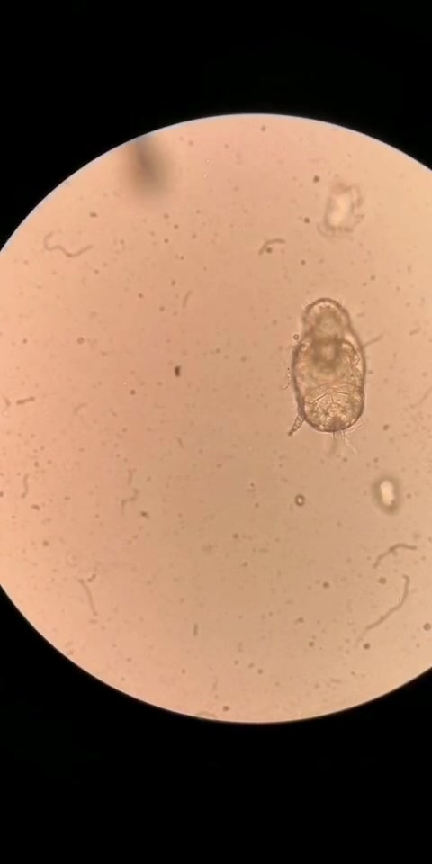 【镜检】被污染的标本-螨虫_哔哩哔哩_bilibili