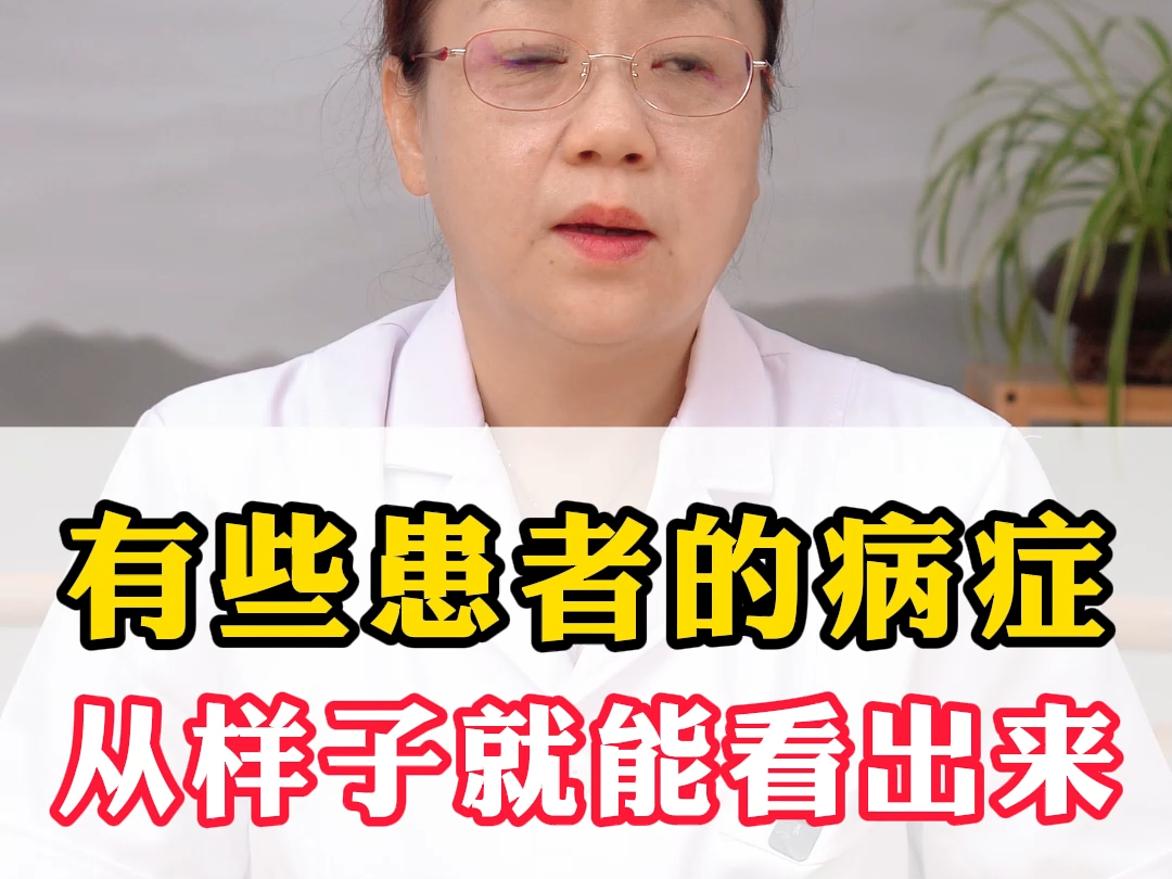 有些患者的病症,从样子就能看出来哔哩哔哩bilibili