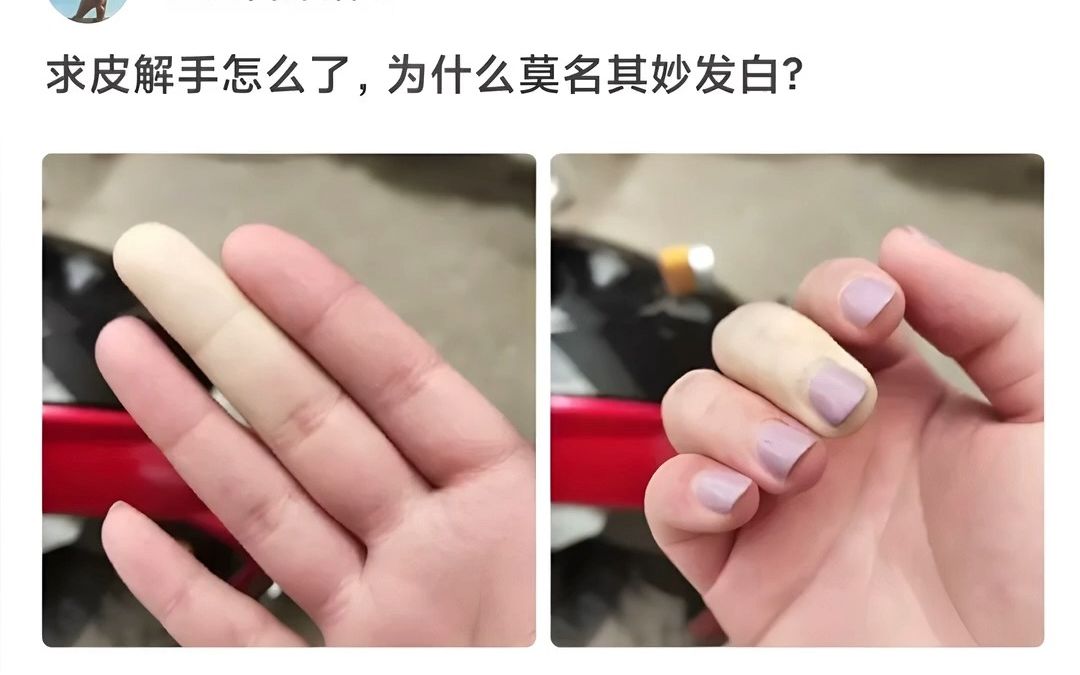 手莫名其妙发白,有没有懂的?哔哩哔哩bilibili