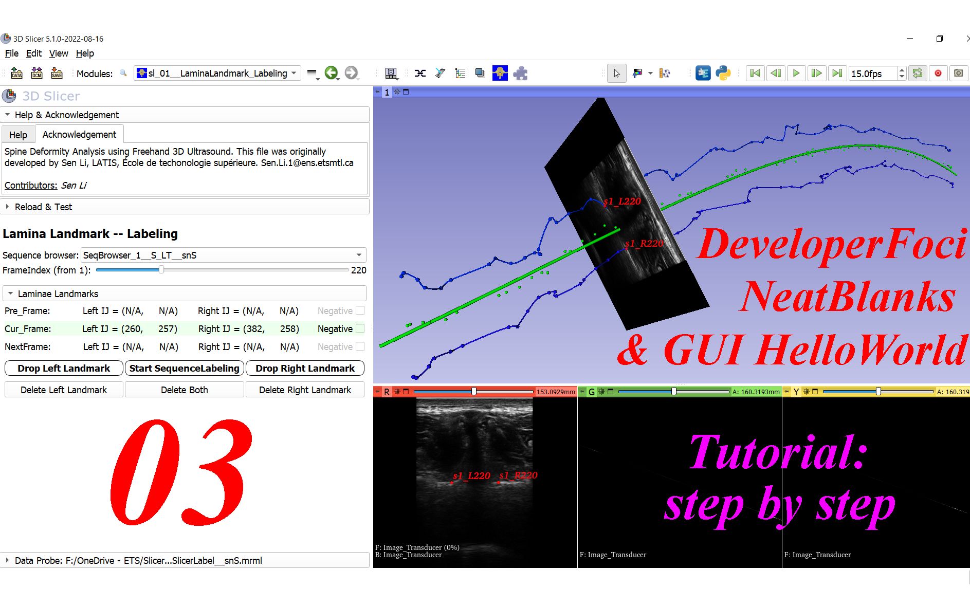 Developer _ Slicer Area, Neat Blanks, GUI HelloWorld -- 3D Slicer ...