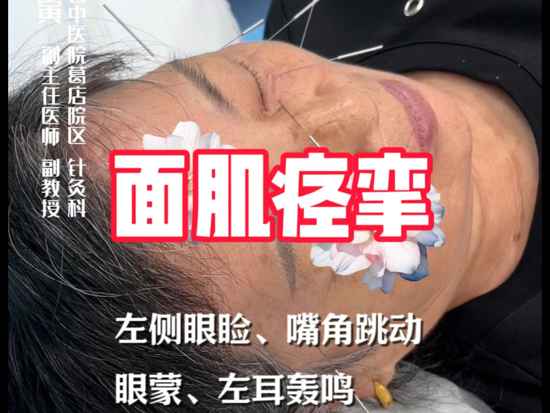 面肌痉挛(左侧眼睑,嘴角跳动,伴有眼蒙,左耳轰鸣)