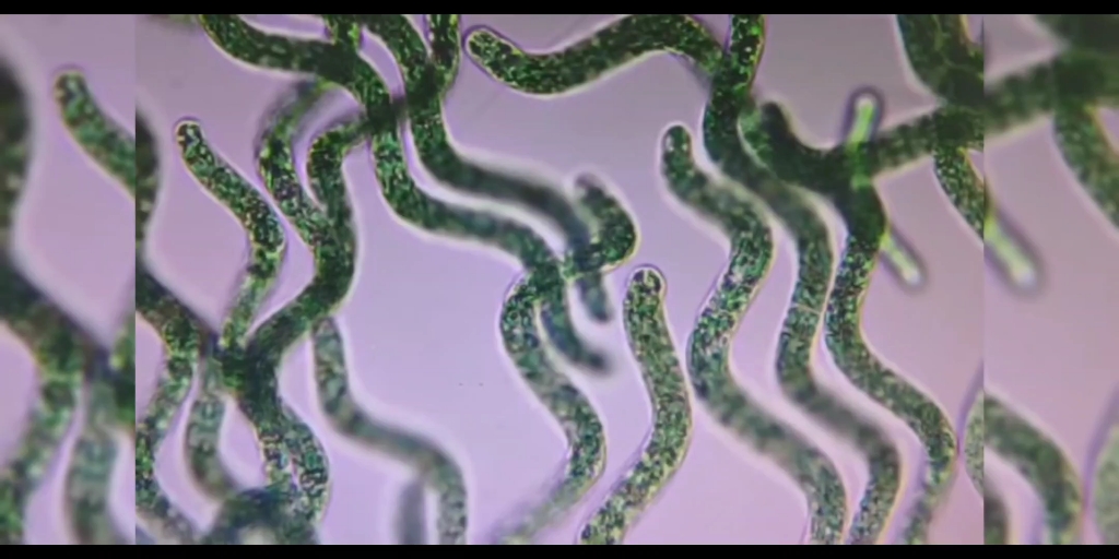 显微镜下的螺旋藻与轮虫