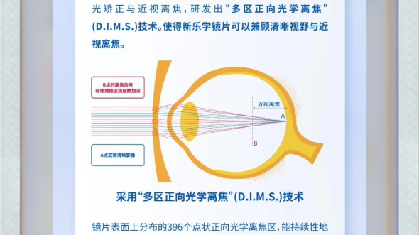 深圳配眼镜,防控镜片选择,蔡司小乐圆,豪雅新乐学,依视路星趣控.