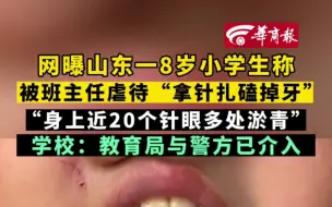 Video herunterladen: 网曝山东一8岁小学生称 被班主任虐待“拿针扎磕掉牙”  “身上近20个针眼多处淤青” 学校：教育局与警方已介入