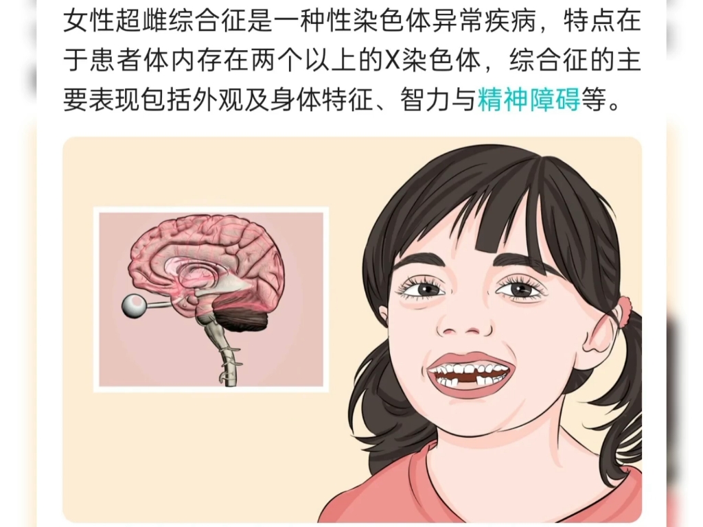 超雌集美是这样的,谁家波刚?