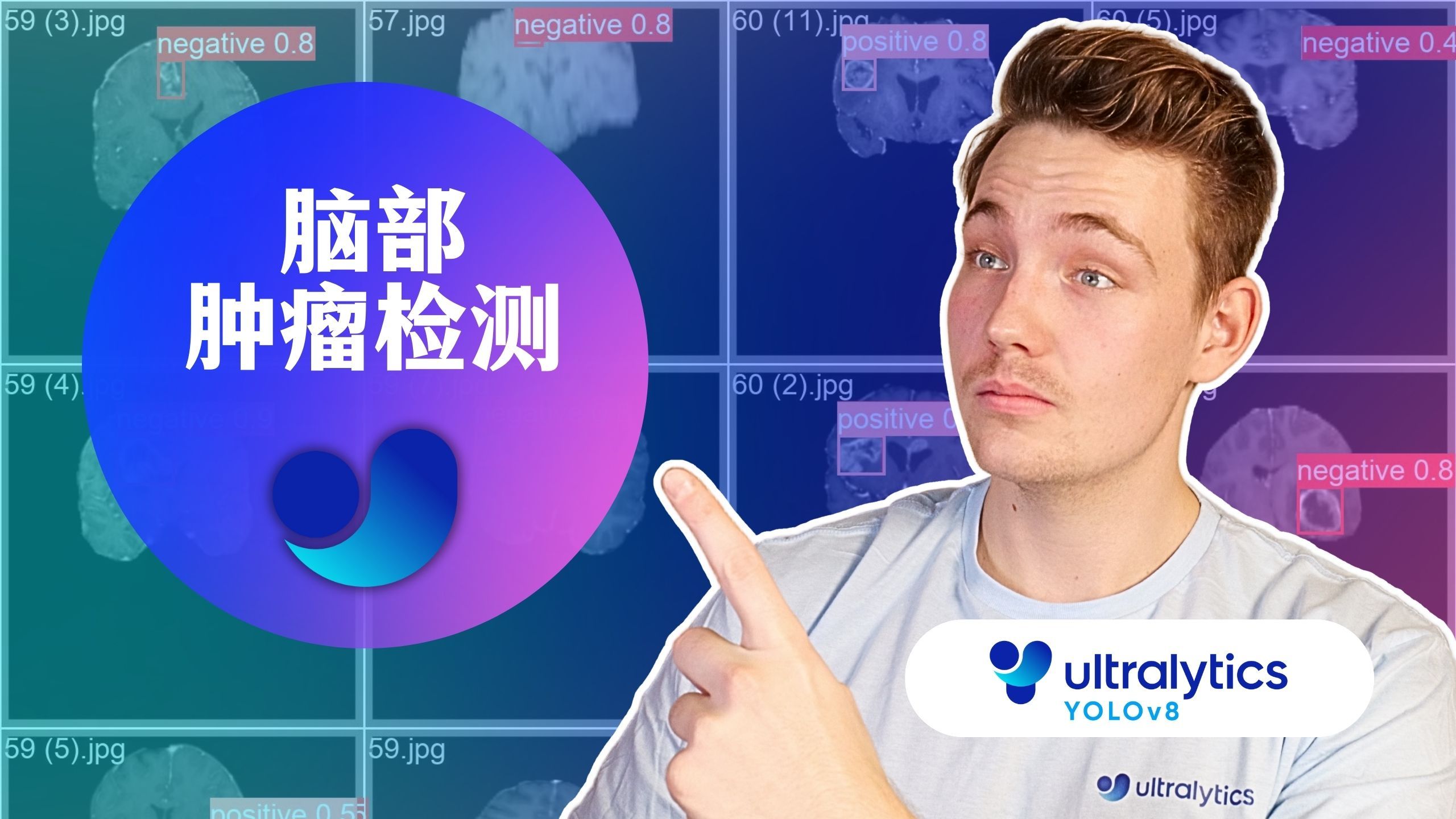 第49集 | 使用 ultralytics hub 进行脑肿瘤检测