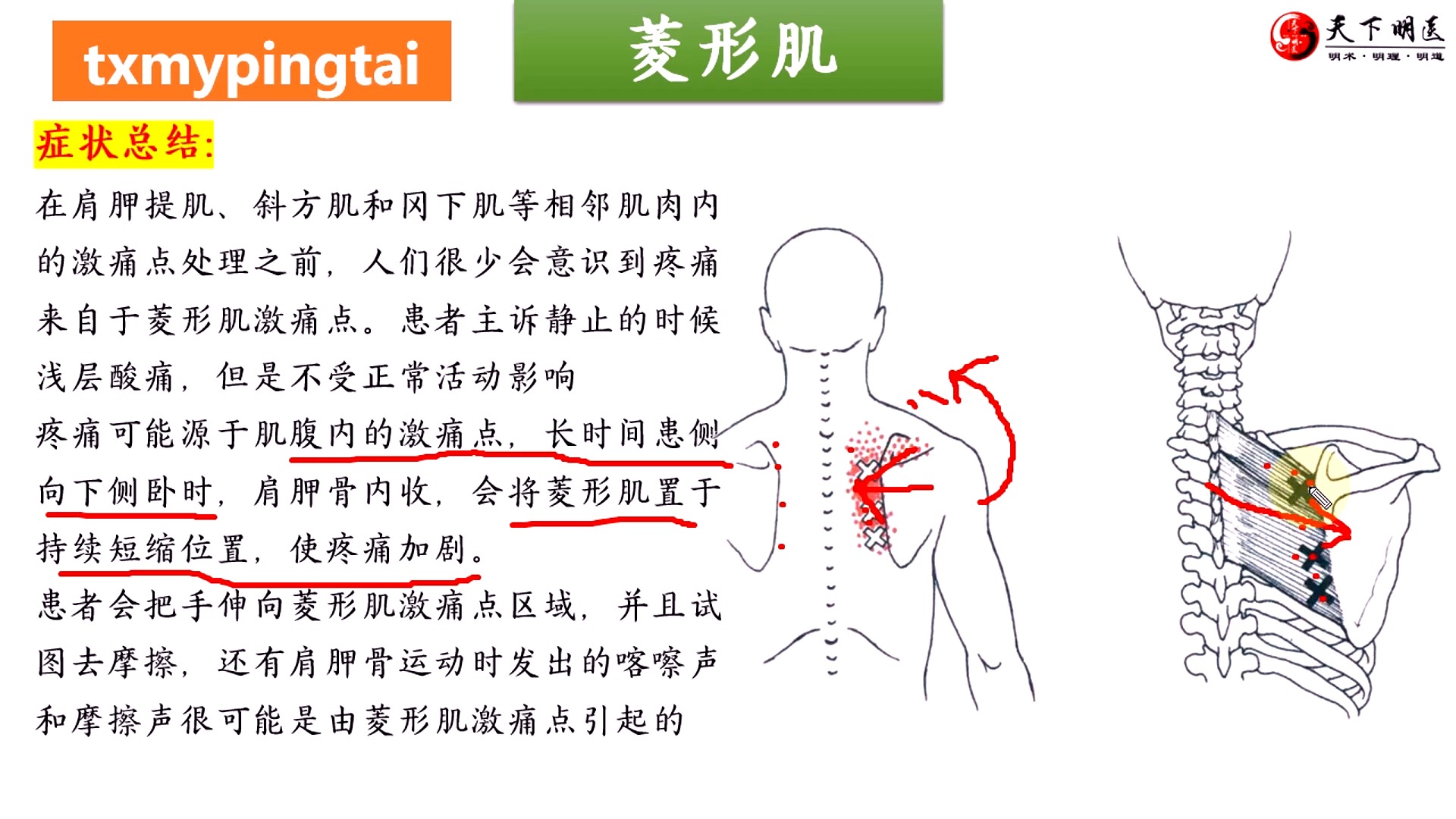 肩胛征常见于图片