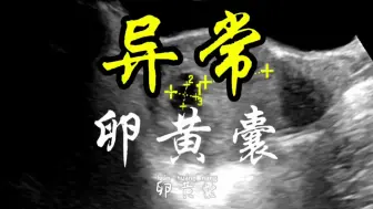 Descargar video: 异常卵黄囊