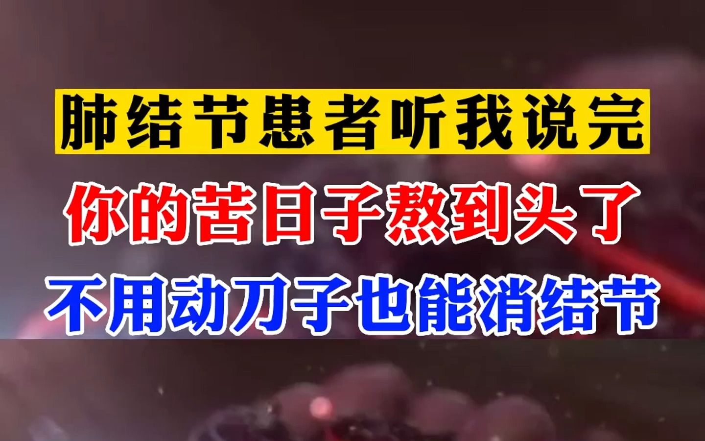 肺结节患者听我说,你的苦日子熬到头了!