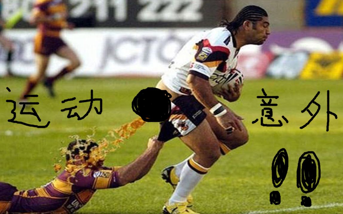 极限运动中残酷/爆笑的意外合辑