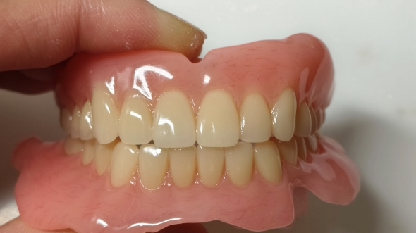 骆聪-齿技活动全口义齿成品记录-直面型-浅覆颌浅覆盖-舌侧集中颌