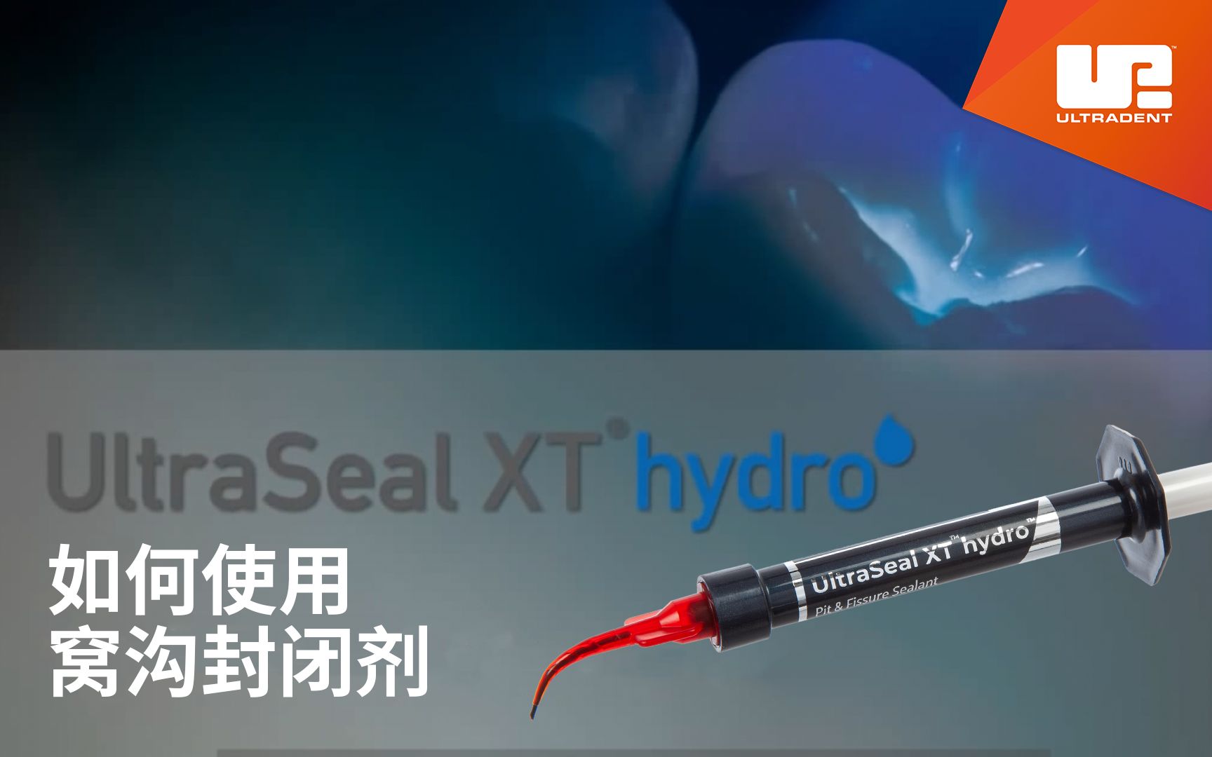 【教程】一步一步,如何使用UltraSeal XT hydro亲水性窝沟封闭剂哔哩哔哩bilibili