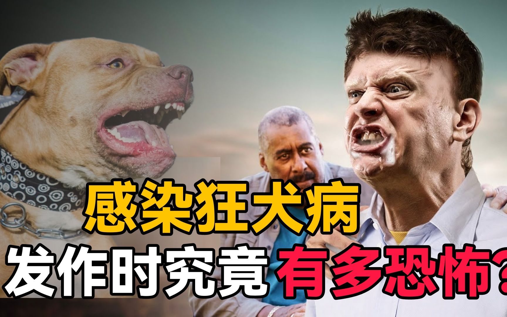 狂犬病患者病發時,究竟有多恐怖?全身潰爛口吐白沫猶如喪屍!