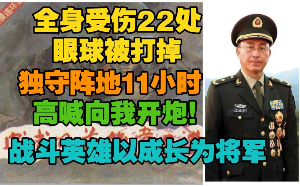 [图]受伤22处，眼球被打掉，独守阵地11小时，对炮兵高喊向我开炮，八一勋章获得者战斗英雄如今已经成为将军。