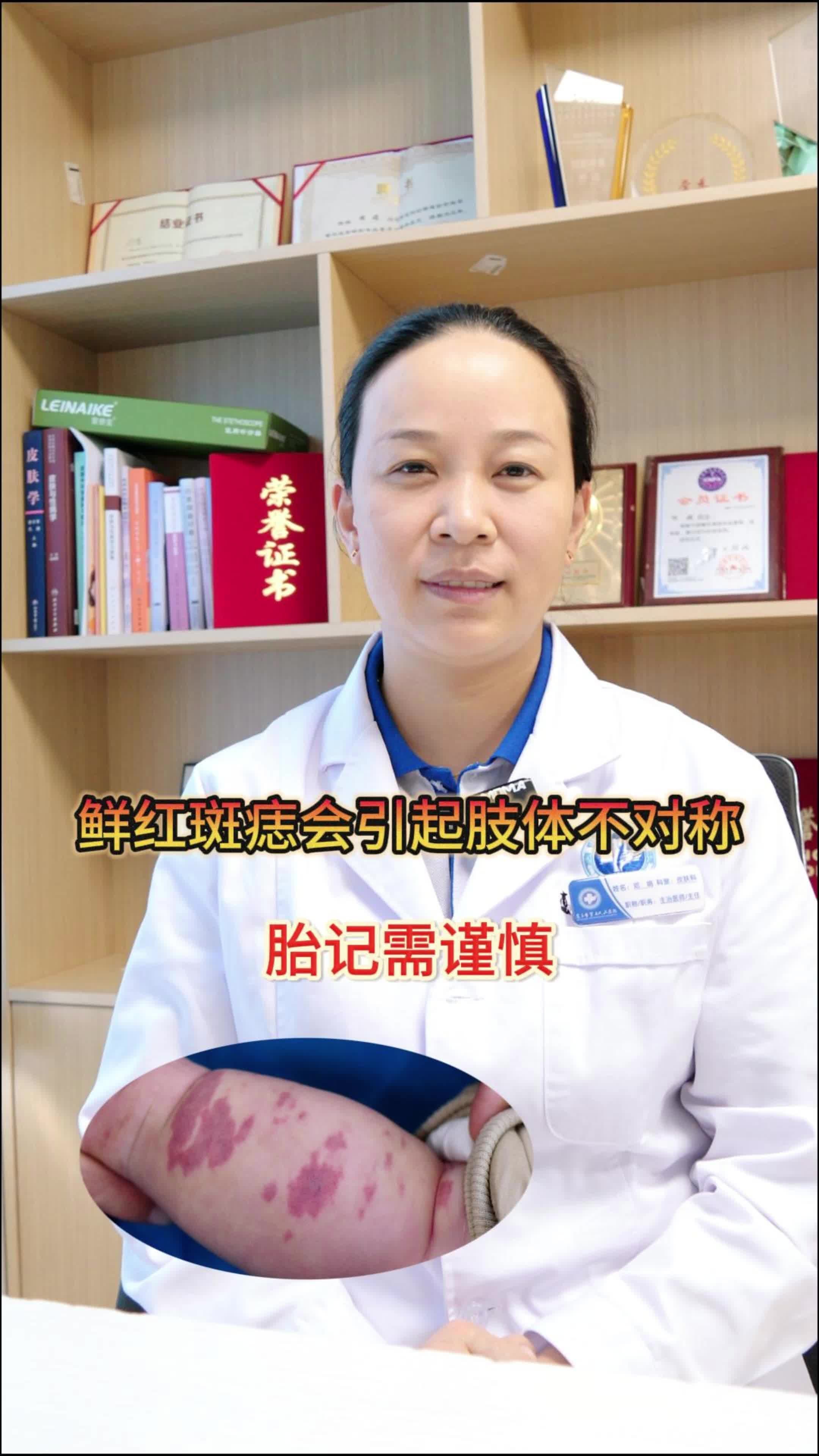 鲜红斑痣不及时治疗会产生什么后果?