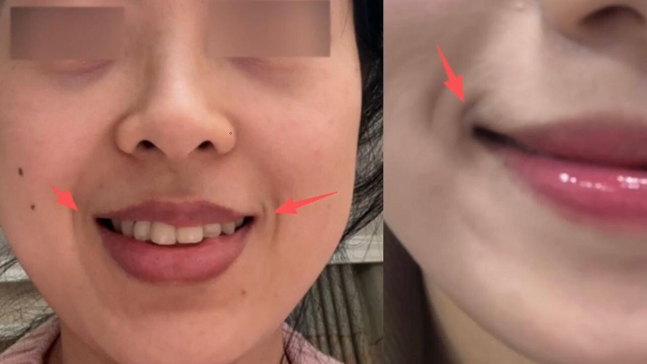 面相识人，口角括号纹_哔哩哔哩_bilibili