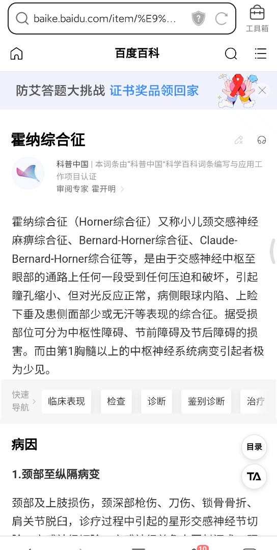 Horner综合征(分享8)哔哩哔哩bilibili