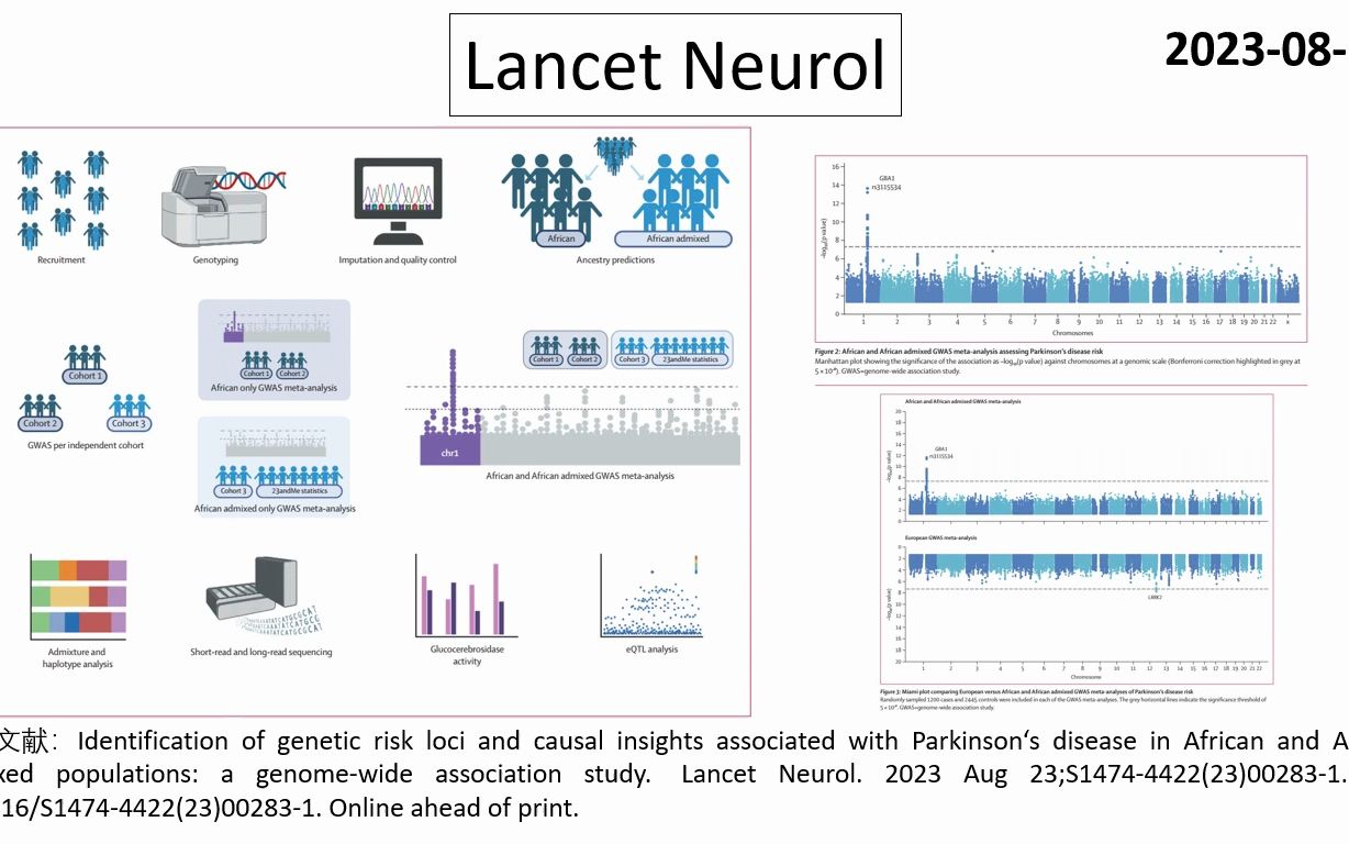 Lancet Neurol—1/3以上的非洲裔帕金森病患者都可能携带致病基因:GBA1 rs3115534哔哩哔哩bilibili