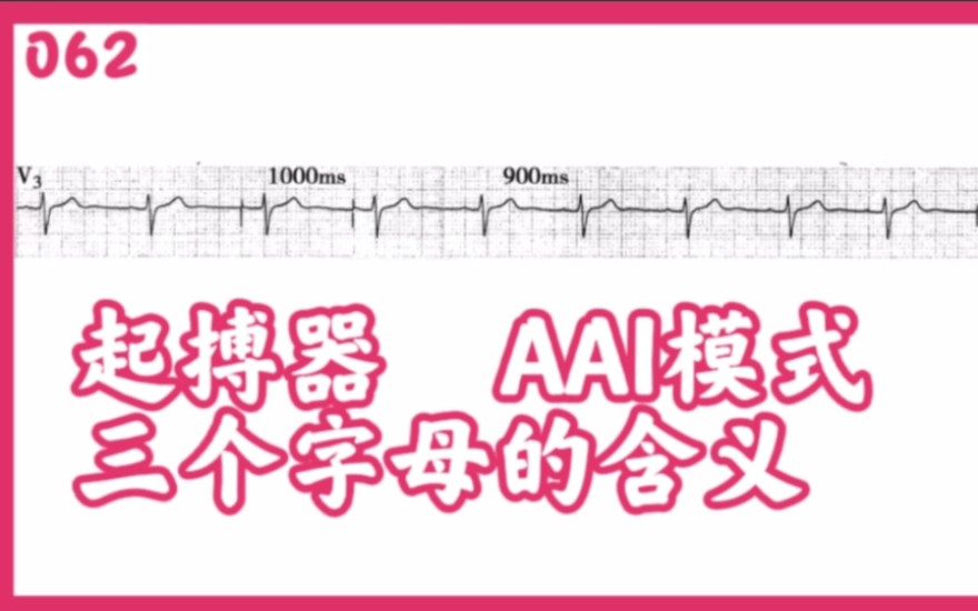 小知识 起搏器AAI模式每个字母的含义哔哩哔哩bilibili