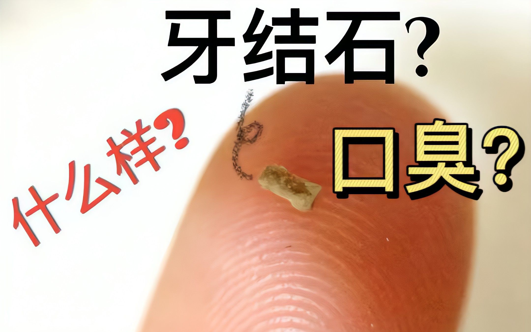 堆積如山的牙結石又黑又臭?過來人分享去臭經驗,在家口氣清新!