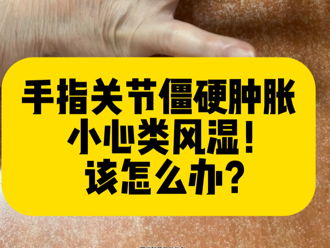 手指关节僵硬肿胀,小心类风湿关节炎!该怎么办!哔哩哔哩bilibili