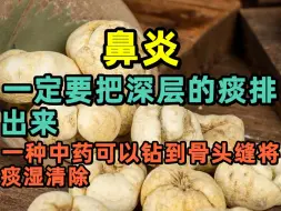 Download Video: 鼻炎一定要把深层的痰排出来，一种中药可以钻到骨头缝将痰湿清除