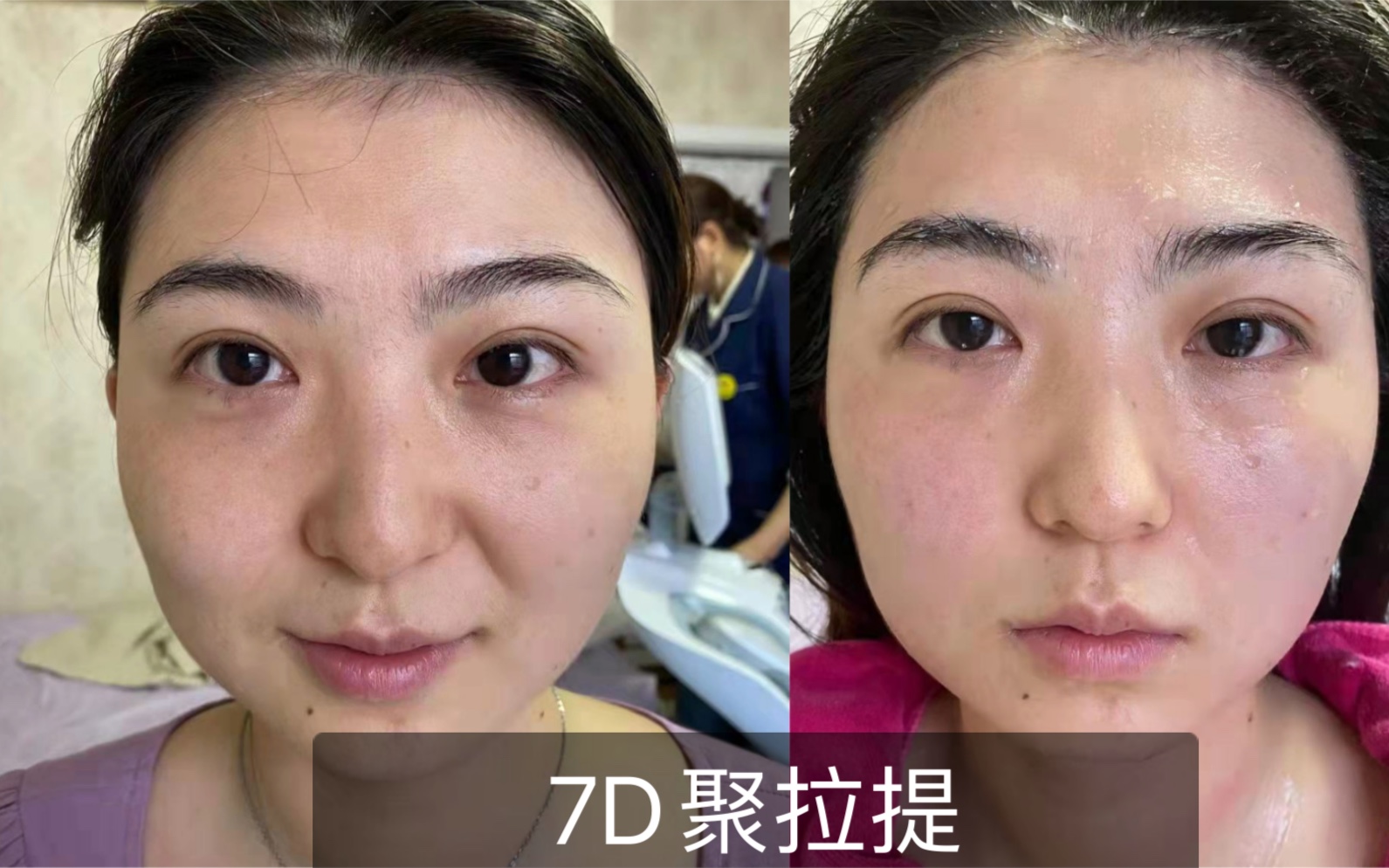 7d聚拉提要不要做?我的小心得_哔哩哔哩_bilibili