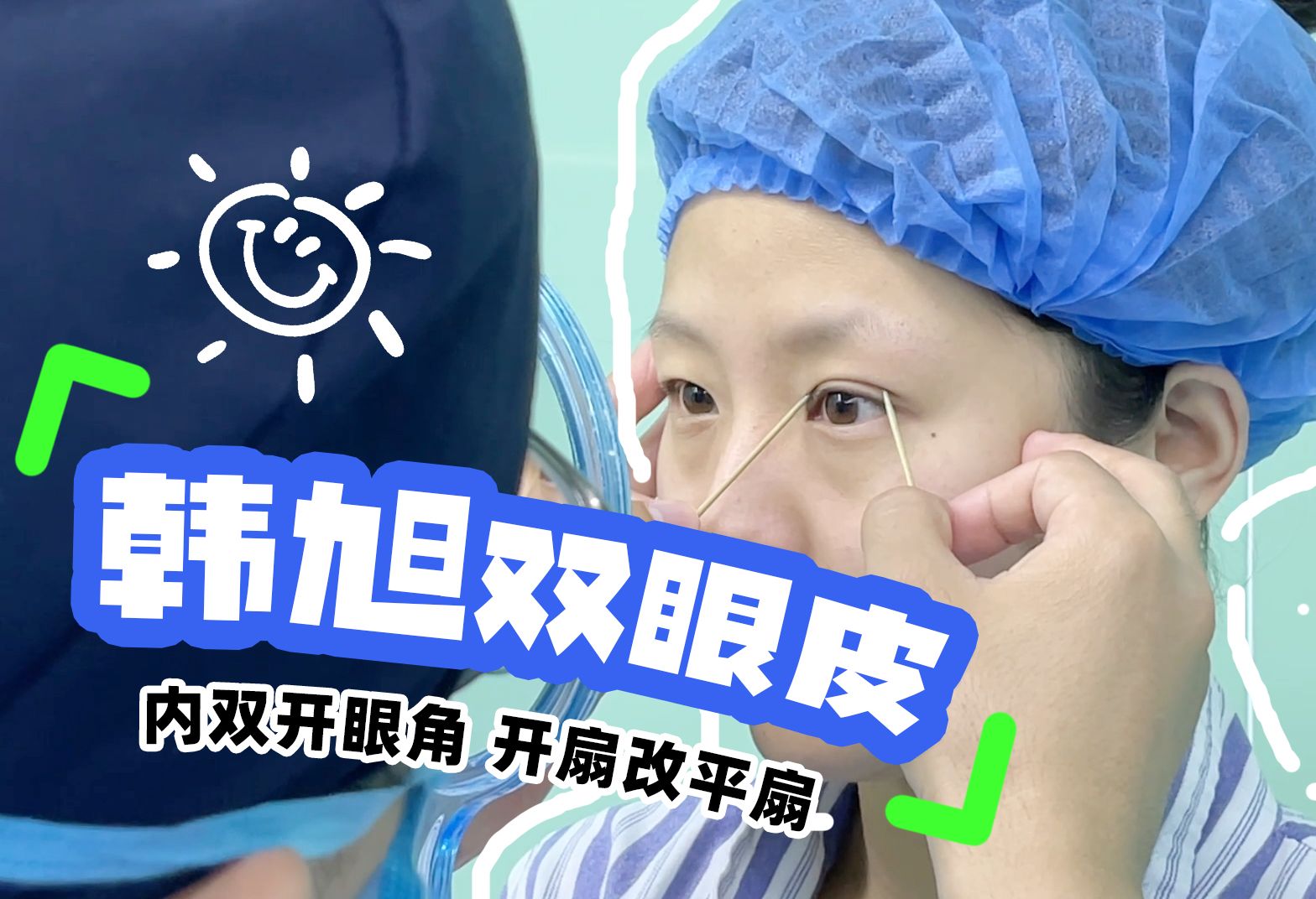 双眼皮内双改平扇,即刻领取幼态"小鹿眼"!济南韩旭双眼皮