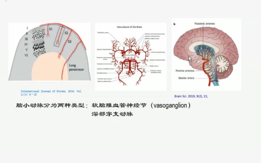 [图]脑小血管病MRI临床思维训练-冯逢