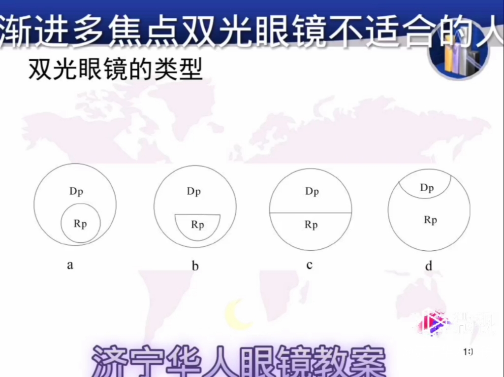 济宁专业配镜渐进多焦点双光眼镜不适合的人群:融合差,屈光参差,弱视,运动平衡障碍,高度近视等.哔哩哔哩bilibili