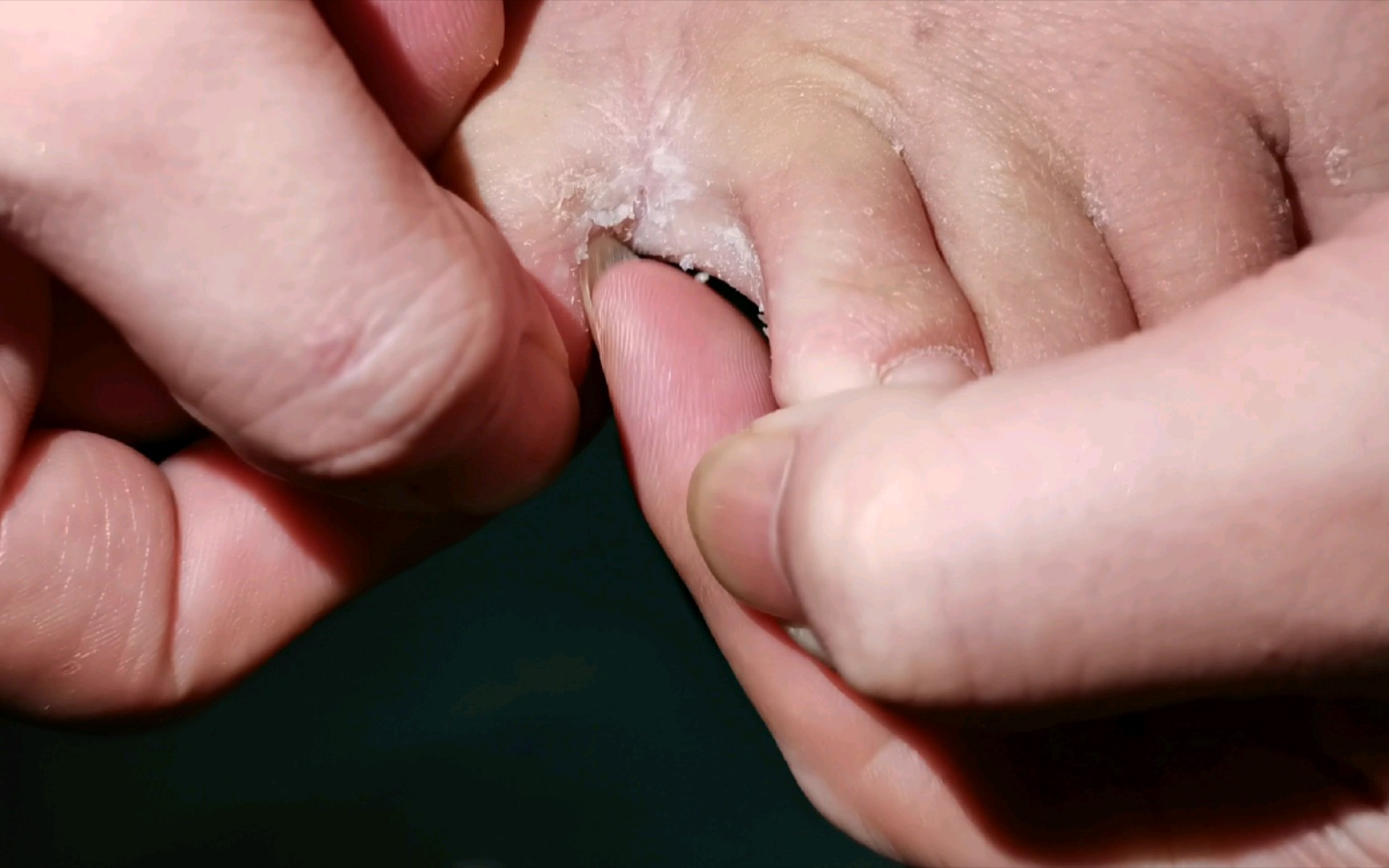 我这脚烂成这样,还有救吗?